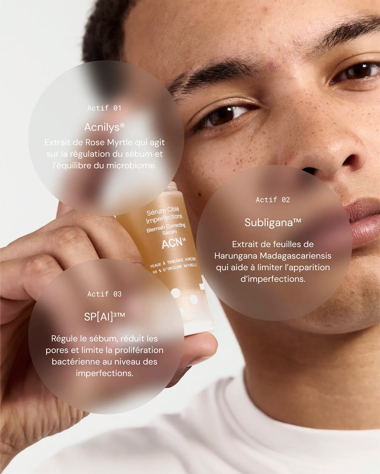 1014-skincare-visage-s-rum-cibl-imperfections-s-bum-localis image 2